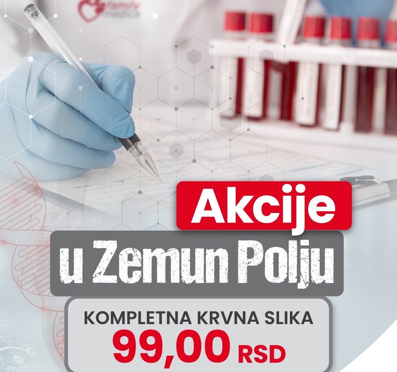 Akcijske cene laboratorijskih paketa u Family Medica Zemun Polje – mala biohemija, biohemija, hormoni štitne žlezde i krvna slika + CRP.